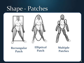 9Shape - PatchesRectangular PatchEllipticalPatchMultiple Patches