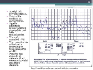 • Austiņā tiek 
pievadīts signāls. 
• Elektrodi ir 
novietoti uz 
galvas vismas. 
• Signāla 
amplitūda 
(mikrovolti) tiek 
atspoguļota pret 
laiku 
(milisekunde). 
• Viļņu pīķi 
numurēti I-VII. 
• Viļņi parasti ar 10 
milisekunžu 
intervālu pēc 
toņa signāla (70- 
90 dB). 
• Pozitīvie pīķi 
atspouļo kā 
aferento, tā arī 
eferento aktivitāti 
smadzeņu 
stumbrā. 
11/3/2014 
http://emedicine.medscape.com/article/836277-overview 
21 
 