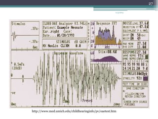 11/3/2014 
http://www.med.umich.edu/childhearinginfo/pv/oaetest.htm 
27 
 