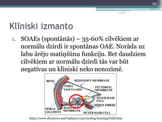 11/3/2014 
Klīniski izmanto 
1. SOAEs (spontānās) – 35-60% cilvēkiem ar 
normālu dzirdi ir spontānas OAE. Norāda uz 
labu ārējo matiņšūnu funkciju. Bet daudziem 
cilvēkiem ar normālu dzirdi tās var būt 
negatīvas un klīniski neko nenozīmē. 
http://www.dizziness-and-balance.com/testing/hearing/OAE.htm 
29 
 