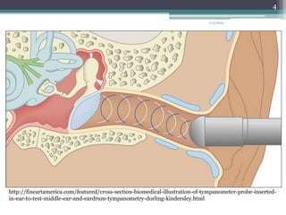 http://fineartamerica.com/featured/cross-section-biomedical-illustration-of-tympanometer-probe-inserted-in- 
ear-to-test-middle-ear-and-eardrum-tympanometry-dorling-kindersley.html 
11/3/2014 
4 
 