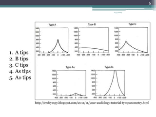 1. A tips 
2. B tips 
3. C tips 
4. As tips 
5. AD tips 
11/3/2014 
6 
http://redeyespy.blogspot.com/2011/11/your-audiology-tutorial-tympanometry.html 
 
