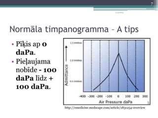 11/3/2014 
Normāla timpanogramma – A tips 
• Pīķis ap 0 
daPa. 
• Pieļaujama 
nobīde - 100 
daPa līdz + 
100 daPa. 
http://emedicine.medscape.com/article/1831254-overview 
7 
 