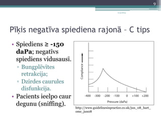 11/3/2014 
Pīķis negatīva spiediena rajonā – C tips 
• Spiediens ≥ -150 
daPa; negatīvs 
spiediens vidusausī. 
▫ Bungplēvītes 
retrakcija; 
▫ Dzirdes caurules 
disfunkcija. 
• Pacients ieelpo caur 
degunu (sniffing). 
http://www.guidelinesinpractice.co.uk/jun_08_hart_ 
ome_jun08 
9 
 