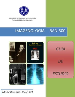 UNIVERSIDAD AUTONOMA DE SANTO DOMINGO
         FACULTAD DE CIENCIAS DE LA SALUD




            IMAGENOLOGIA                    BAN-300



                                              GUIA

                                               DE

                                             ESTUDIO



Modesto Cruz, MD/PhD
 