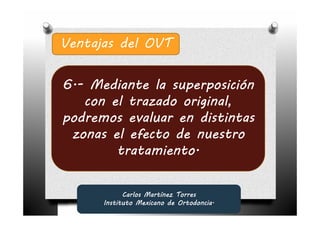 Ventajas del OVT


6.-
6.- Mediante la superposición
    con el trazado original,
podremos evaluar en distintas
 zonas el efecto de nuestro
         tratamiento.


            Carlos Martínez Torres
      Instituto Mexicano de Ortodoncia.
 
