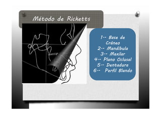 1.-
    1.- Base de
       Cráneo
  2.-
  2.- Mandíbula
    3.-
    3.- Maxilar
4.-
4.- Plano Oclusal
 5.-
 5.- Dentadura
6.-
6.- Perfil Blando
 