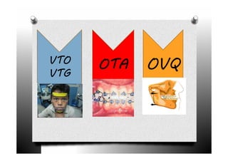 VTO
VTG
      OTA   OVQ
 