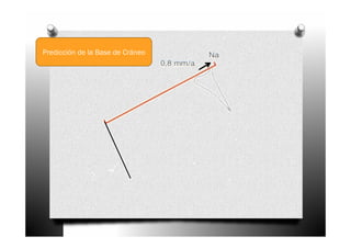 Predicción de la Base de Cráneo
 
