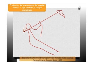 Predicción del crecimiento del maxilar
   inferior – eje condilar y cuerpo
              mandibular
 