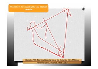 Predicción del crecimiento del maxilar
               superior
 