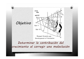 Objetivo



     Determinar la contribución del
crecimiento al corregir una maloclusión
 