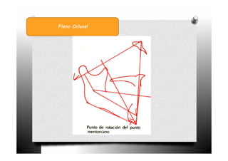 Plano Oclusal
 