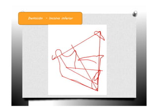 Dentición - Incisivo inferior
 