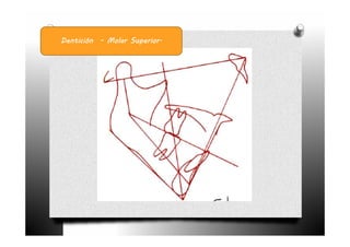 Dentición - Molar Superior.
 