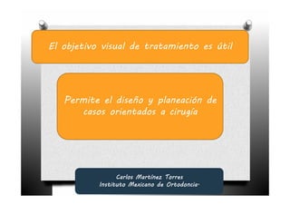 El objetivo visual de tratamiento es útil




   Permite el diseño y planeación de
      casos orientados a cirugía




                 Carlos Martínez Torres
           Instituto Mexicano de Ortodoncia.
 
