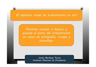 El objetivo visual de tratamiento es útil



      Permite evaluar a futuro y
    pasado el éxito del tratamiento
    en casos de ortopedia, cirugía o
               camuflaje.




                 Carlos Martínez Torres
           Instituto Mexicano de Ortodoncia.
 