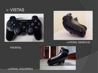 VISTASLATERAL DERECHOFRONTALLATERAL IZQUIERDO