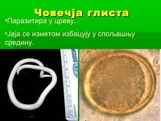 Човечја глиста

•Паразитира у цреву.

•Јаја се изметом избацују у спољашњу
средину.

 