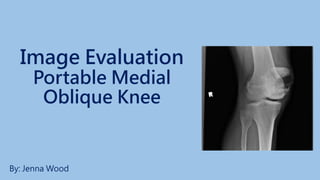 Image Evaluation
Portable Medial
Oblique Knee
By: Jenna Wood
 