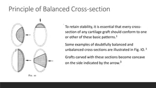 Split And Rib Method Oblique Split Method Rib Cartilage Tastan | PPTX