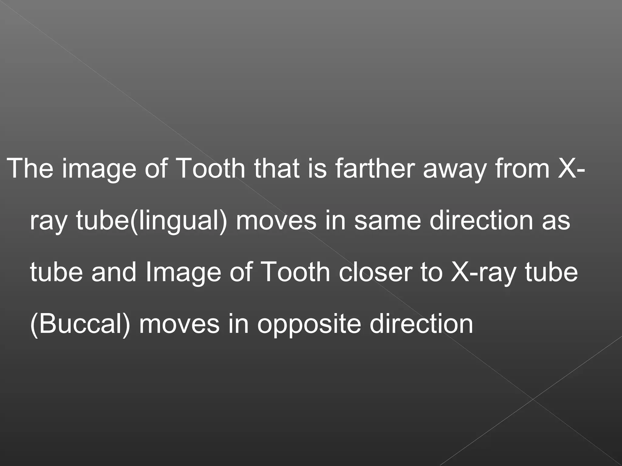 The image of Tooth that is farther away from X-ray 
tube(lingual) moves in same direction as 
tube and Image of Tooth closer to X-ray tube 
(Buccal) moves in opposite direction 
 