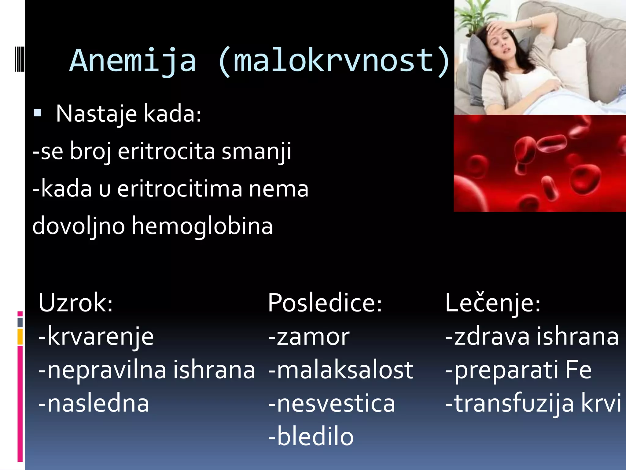 Anemija (malokrvnost)
 Nastaje kada:
-se broj eritrocita smanji
-kada u eritrocitima nema
dovoljno hemoglobina
Posledice:
-zamor
-malaksalost
-nesvestica
-bledilo
Lečenje:
-zdrava ishrana
-preparati Fe
-transfuzija krvi
Uzrok:
-krvarenje
-nepravilna ishrana
-nasledna
 