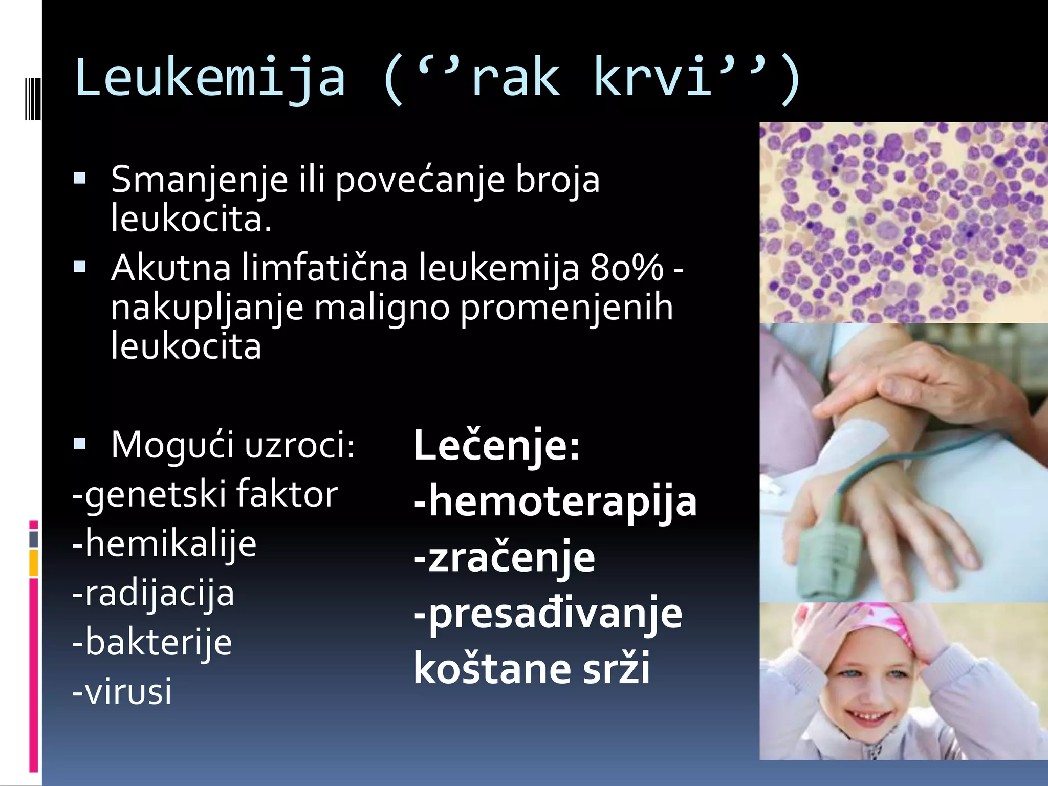 Leukemija (‘’rak krvi’’)
 Smanjenje ili povećanje broja
leukocita.
 Akutna limfatična leukemija 80% -
nakupljanje maligno promenjenih
leukocita
 Mogući uzroci:
-genetski faktor
-hemikalije
-radijacija
-bakterije
-virusi
Lečenje:
-hemoterapija
-zračenje
-presađivanje
koštane srži
 