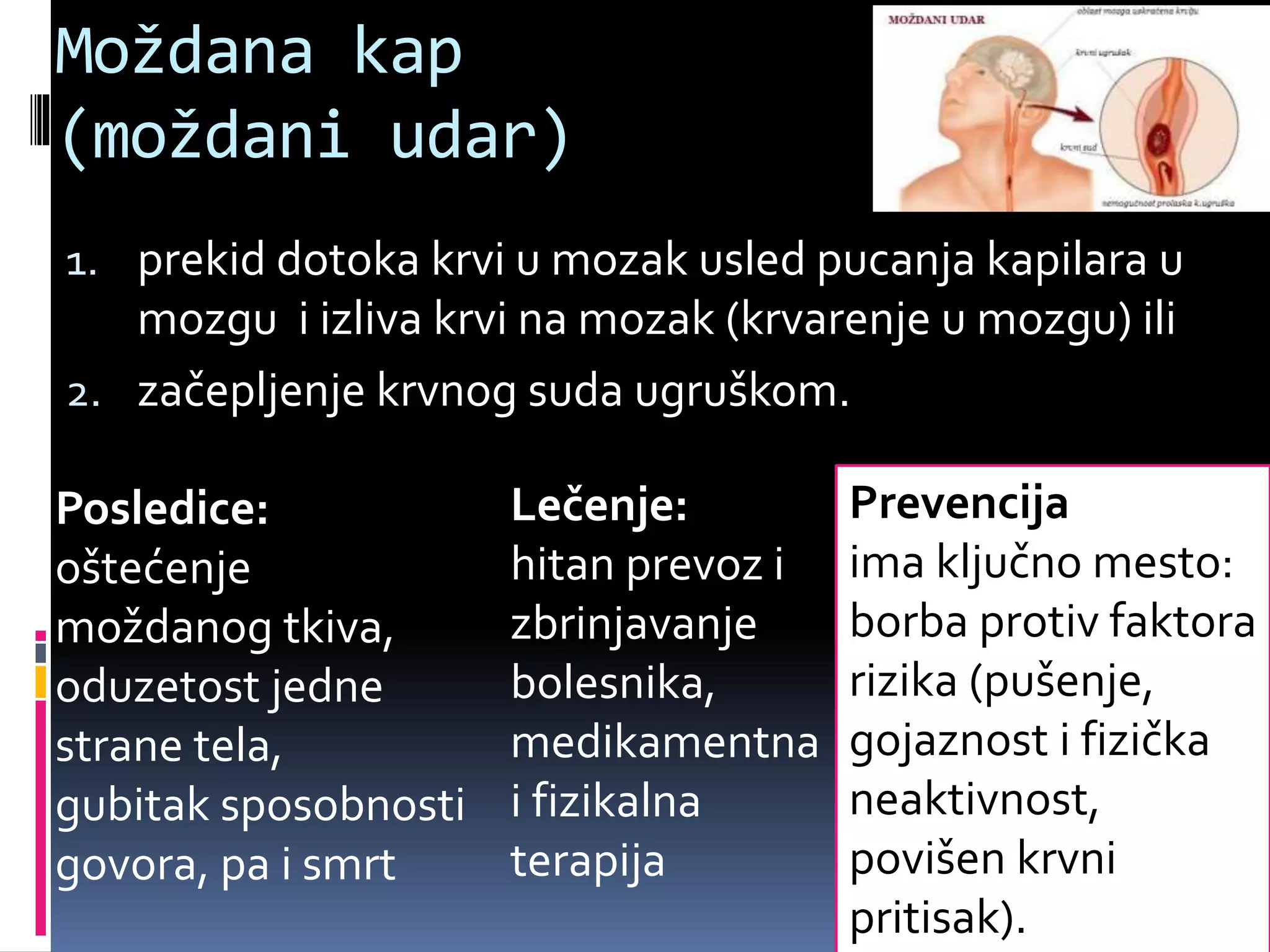 Moždana kap
(moždani udar)
1. prekid dotoka krvi u mozak usled pucanja kapilara u
mozgu i izliva krvi na mozak (krvarenje u mozgu) ili
2. začepljenje krvnog suda ugruškom.
Prevencija
ima ključno mesto:
borba protiv faktora
rizika (pušenje,
gojaznost i fizička
neaktivnost,
povišen krvni
pritisak).
Lečenje:
hitan prevoz i
zbrinjavanje
bolesnika,
medikamentna
i fizikalna
terapija
Posledice:
oštećenje
moždanog tkiva,
oduzetost jedne
strane tela,
gubitak sposobnosti
govora, pa i smrt
 