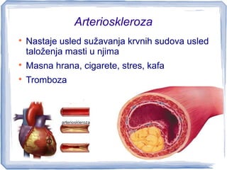 Arterioskleroza

Nastaje usled sužavanja krvnih sudova usled
taloženja masti u njima

Masna hrana, cigarete, stres, kafa...