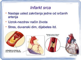 Infarkt srca

Nastaje usled zakrčenja jedne od srčanih
arterija

Uzrok-nezdrav način života

Stres, duvanski dim, dijabetes itd.
 
