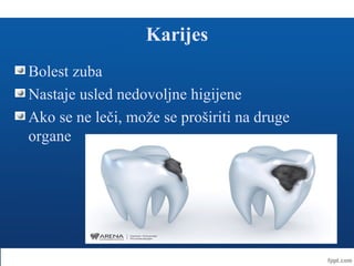 Karijes
Bolest zuba
Nastaje usled nedovoljne higijene
Ako se ne leči, može se proširiti na druge
organe
 