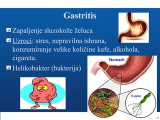 Gastritis
Zapaljenje sluzokože želuca
Uzroci: stres, nepravilna ishrana,
konzumiranje velike količine kafe, alkohola,
cigareta.
Helikobakter (bakterija)
 