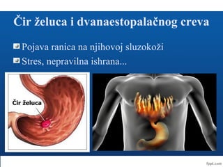 Čir želuca i dvanaestopalačnog creva
Pojava ranica na njihovoj sluzokoži
Stres, nepravilna ishrana...
 