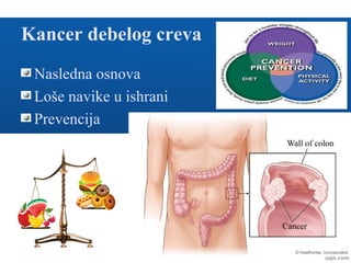 Kancer debelog creva
Nasledna osnova
Loše navike u ishrani
Prevencija
 