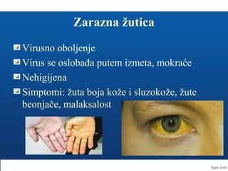 Zarazna žutica
Virusno oboljenje
Virus se oslobađa putem izmeta, mokraće
Nehigijena
Simptomi: žuta boja kože i sluzokože, žute
beonjače, malaksalost
 