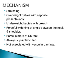  Stretching
 Overweight babies with cephalic
presentations
 Underweight babies with breech
 Forceful widening of angle between the neck
& shoulder.
 Force is more at C5 root
 Always supraclavicular
 Not associated with vascular damage.
 