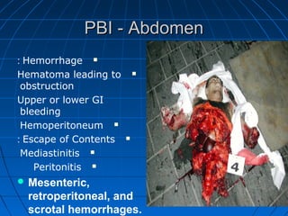 PBI - AbdomenPBI - Abdomen
Hemorrhage:
Hematoma leading to
obstruction
Upper or lower GI
bleeding
Hemoperitoneum
Escape of Contents:
Mediastinitis
Peritonitis
 Mesenteric,
retroperitoneal, and
scrotal hemorrhages.
 