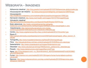 WEBGRAFÍA - IMAGENES
1. Adherencia intestinal: http://img.yasalud.com/uploads/2012/07/Adherencias-abdominales.jpg
2. Intususcepción del intestino: ttp://www.prescripcioninteligente.com/ippac/es1290763.jpg
3. Intususcepción:
http://healthcare.walgreens.com/marketing/library/graphics/images/es/12682.jpg
4. Herniación intestinal: http://www.med-health.net/images/10415779/image002.jpg
5. Volvulación intestinal:
http://princetonhcs.kramesonline.com/Spanish/HealthSheets/103774.img
6. Dolor abdominal: http://static.commentcamarche.net/sante-
medecine.commentcamarche.net/faq/images/rStHNaDi-photo-oesophagite-s-.png
7. Estreñimiento: http://advancedsurgicalcare.com.mx/wp-
content/uploads/2013/04/obstruccion-intestinal-2-480x252.jpg
8. Vomito: http://www.vegetarianoschile.cl/wp-content/uploads/2012/10/vomito1.jpg
9. Rayos X :
http://upload.wikimedia.org/wikipedia/commons/5/56/Gastroesophageal_reflux_barium_X-
ray.jpg
10. Tomografía: http://www.hospitalmontesinai.org/fotos2012/tomografia.jpg
11. Fibra: http://atusaludenlinea.com/wp-content/uploads/2015/05/fibra-a-tu-salud.jpg
12. Sedentarismo: http://www.cosasdesalud.es/images/Sedentarismo.jpg
13. Obesidad: http://www.saludactual.cl/imag/7882factores_poblaciones_obesidad.jpg
14. Pesado: :http://www.datoanuncios.org/images/Ejercicio07.jpg
15. Agua: http://2.bp.blogspot.com/---w_5lUsV9I/UkAcG_NOYZI/AAAAAAAAD7o/sESf33lMZ-
w/s1600/agua.png
16. Fumar: http://mexico.cnn.com/media/2013/01/30/cigarro-fumar-humo-tabaco-pulmon-
cancer.jpg
17. Ejercicio: http://www.mokananutricion.com/wp-content/uploads/2014/06/ejercicios-para-
adelgazar-rapido.jpg
 