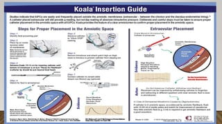 Obs All Lectures Indexed Pdf