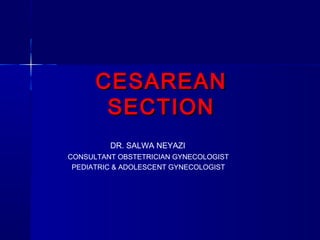 CESAREANCESAREAN
SECTIONSECTION
DR. SALWA NEYAZI
CONSULTANT OBSTETRICIAN GYNECOLOGIST
PEDIATRIC & ADOLESCENT GYNECOLOGIST
 
