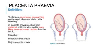 PLACENTA PRAEVIA
“A placenta covering or encroaching
on the cervical os associated with
bleeding.”
in placenta previa,bleeding from
maternal not from fetus and is more
likely to compromise mother than the
fetus,
It can be :
Minor placenta previa.
Major placenta previa.
 