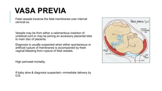 VASA PREVIA
Fetal vessels traverse the fetal membranes over internal
cervical os.
Vessels may be from either a velamentous insertion of
umbilical cord or may be joining an accessory placental lobe
to main disc of placenta.
Diagnosis is usually suspected when either spontaneous or
artificial rupture of membranes is accompanied by fresh
vaginal bleeding from rupture of fetal vessels.
High perinatal mortality.
If baby alive & diagnosis suspected---immediate delivery by
C/S.
 
