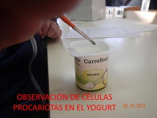 OBSERVACIÓN DE CÉLULAS
PROCARIOTAS EN EL YOGURT
 