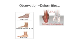 Observation –Deformities…
 