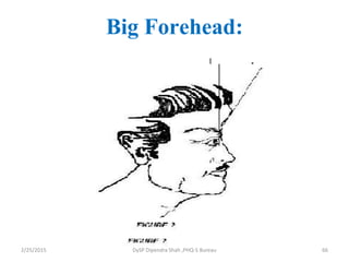 Big Forehead:
2/25/2015 66DySP Dipendra Shah ,PHQ-S Bureau
 