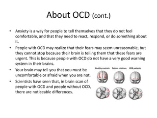 Obsessive Compulsive Disorder | PPTX
