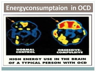 Energyconsumptaion in OCD
 