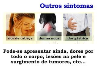 Outros sintomas




Pode-se apresentar ainda, dores por
  todo o corpo, lesões na pele e
  surgimento de tumores, etc...
 