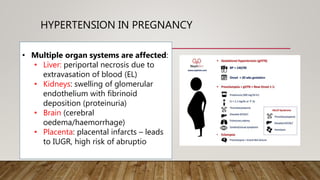 HYPERTENSION IN PREGNANCY
• Multiple organ systems are affected:
• Liver: periportal necrosis due to
extravasation of blood (EL)
• Kidneys: swelling of glomerular
endothelium with fibrinoid
deposition (proteinuria)
• Brain (cerebral
oedema/haemorrhage)
• Placenta: placental infarcts – leads
to IUGR, high risk of abruptio
 